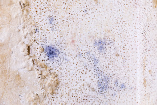 Durch ein feuchtes Mauerwerk entstehen Wandverfärbungen, welche zu einem Schimmelbefall führen können. 